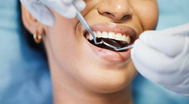 Best Dental Fillings (Composite and Amalgam)  in University Center, VA